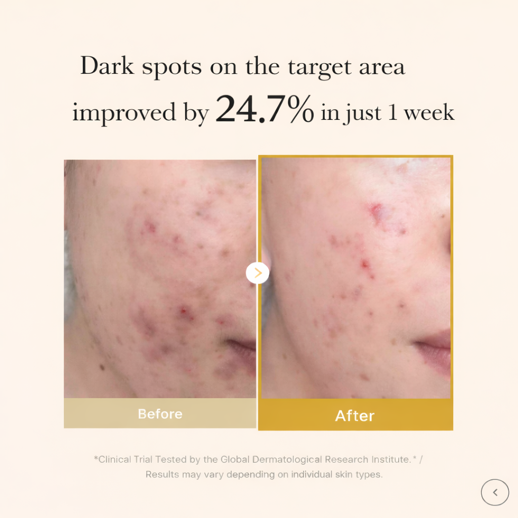 GlowSeal - Visibly Reduces Dark Marks From Skin Picking In Just 30 Days